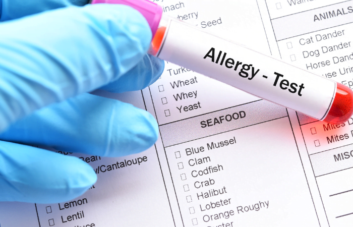 common allergy problems